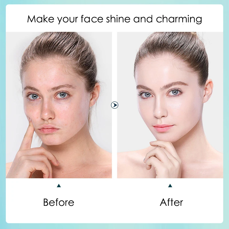 10 Stück Hyaluronsäure feuchti – Sheet Face Mask Pack Bewertung und Preis